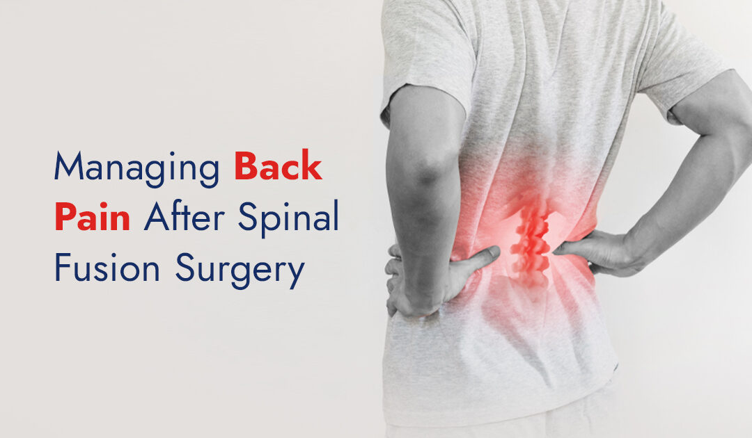 Back Pain After Spinal Fusion Surgery