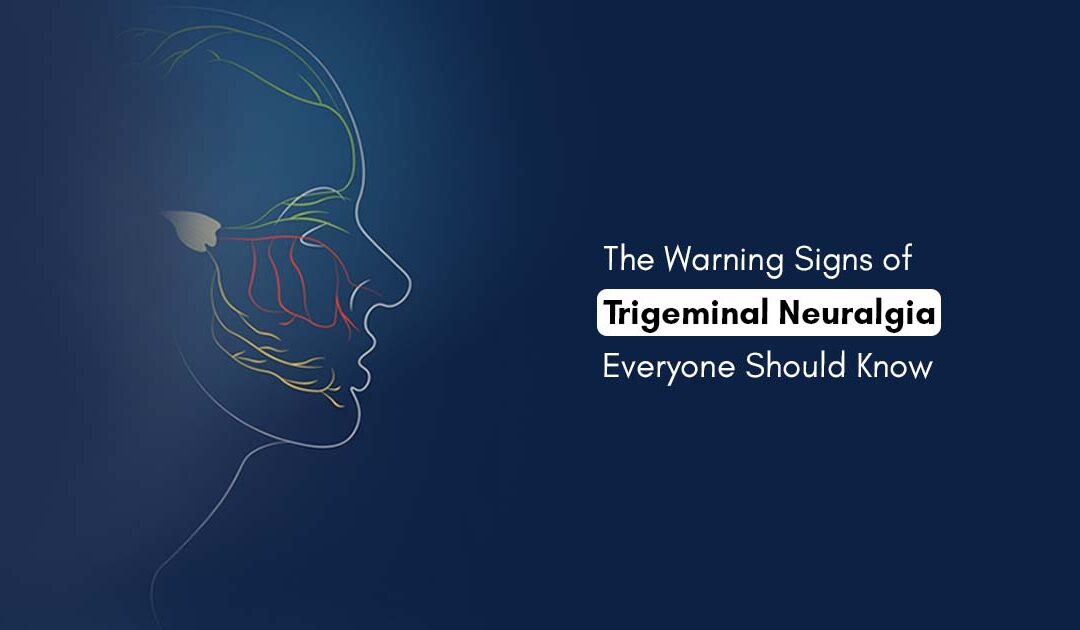 The Warning Signs of Trigeminal Neuralgia Everyone Should Know