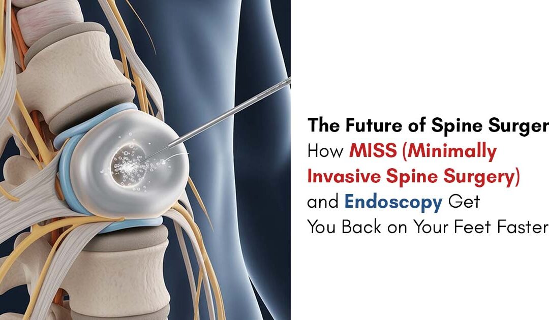 The Future of Spine Surgery: How MISS (Minimally Invasive Spine Surgery) and Endoscopy Get You Back on Your Feet Faster